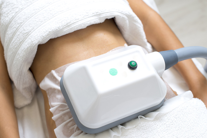 La cryolipolyse : le froid pour combattre le surpoid​s